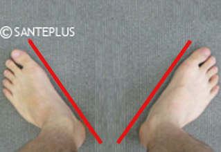 EPPO Basic Position Feet Position